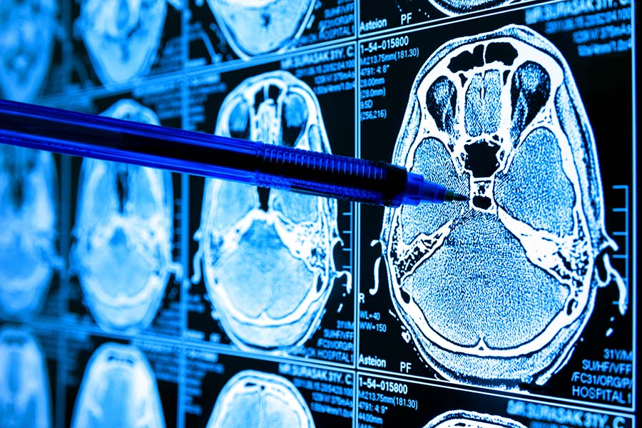 Neurotechnology Webinar Series: Dementia Biodesign