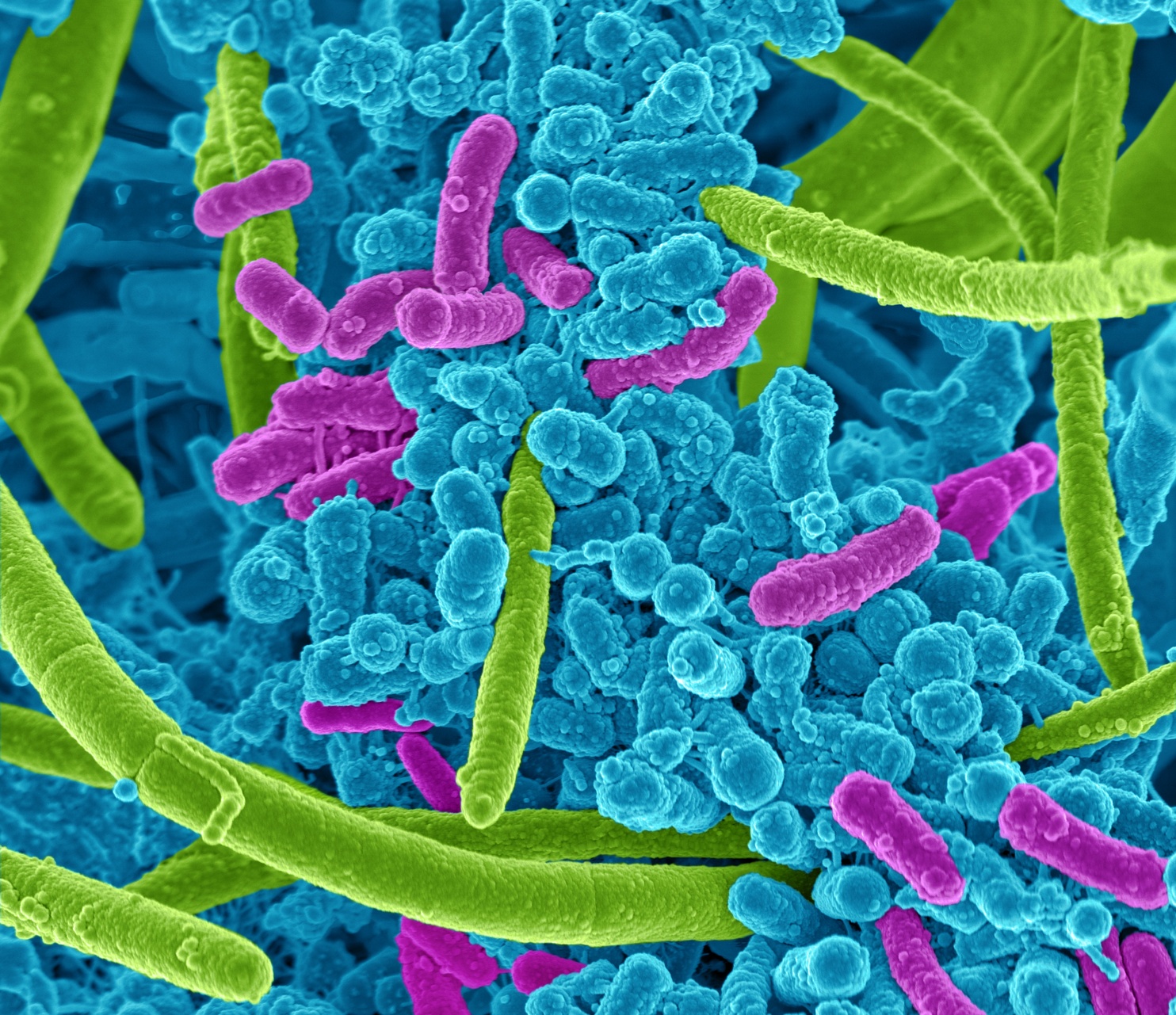 Exploring Microbiome Innovation: Insights from the Microbiome One Health Conference