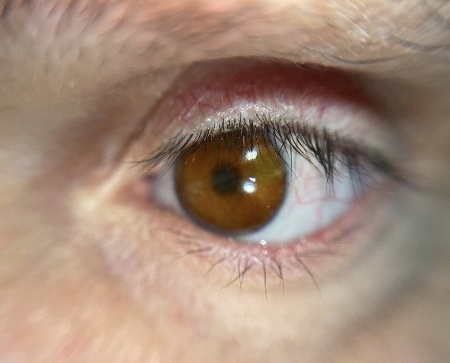 IP audit for firm behind world's first 3D-printed prosthetic eye